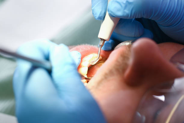 Best Pediatric Emergency Dentist in Findlay, OH